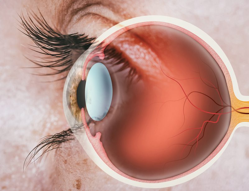 Detailed cross-section illustration of the eye demonstrating corneal and lens anatomy related to modern vision correction techniques for smile operation eye – smile operation eye